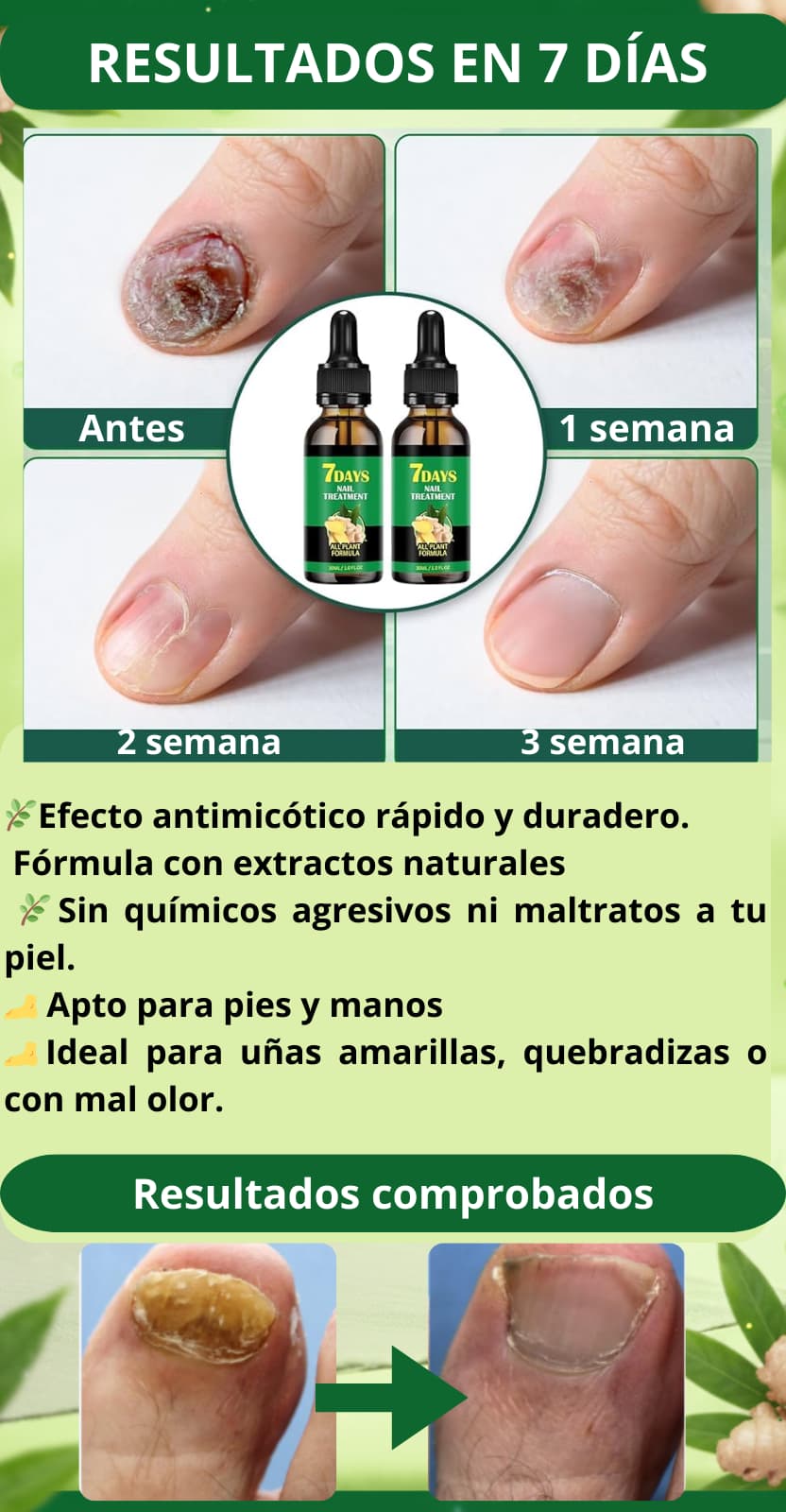 🌿 Antihongos 7 Días | Recupera tus Uñas