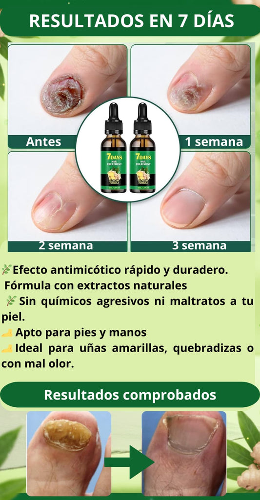 🌿 Antihongos 7 Días | Recupera tus Uñas